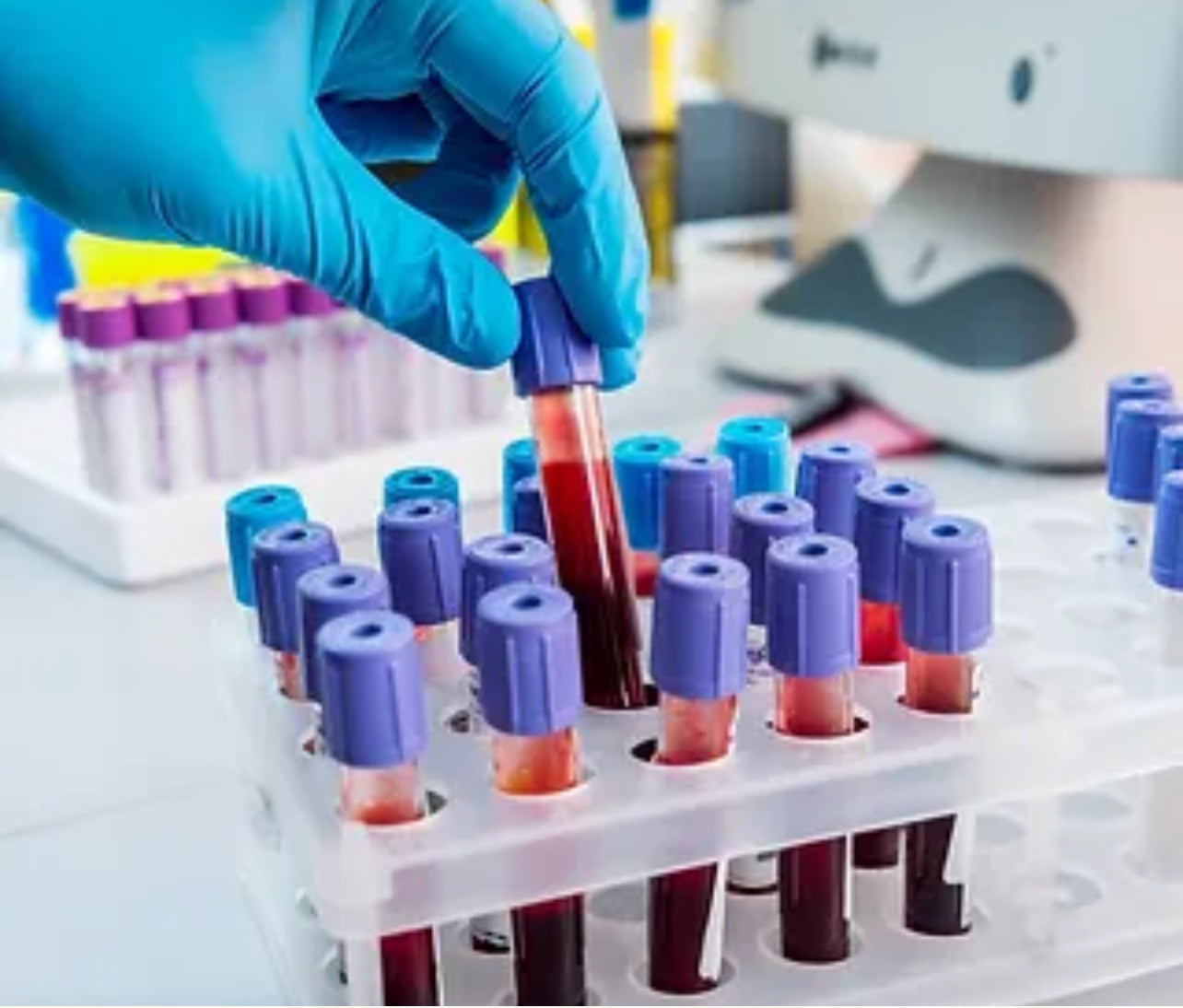 Pre-Op Lab Work for Cosmetic Surgery